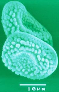 REM-Aufnahme von Äzidiosporen