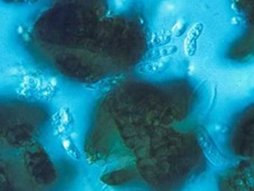 Askosporen des Pilzes, befallen Ende Mai bis Anfang Juli junge Nadeln.