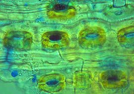 Das Mycel des Pilzes (Bild oben, blau gefärbt) durchdringt das junge Pflanzengewebe